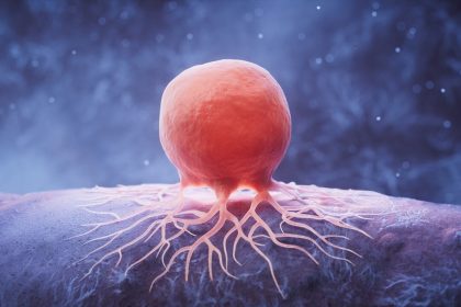 Cancer : ce ne sont pas que nos gènes, découvrez les véritables déclencheurs