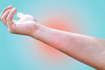 Remèdes maison simples pour soigner brûlures, coupures et piqûres d’insectes