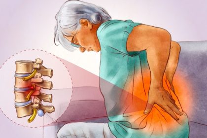 Sciatique : une douleur fréquente liée au plus grand nerf du corps — 4 solutions naturelles pour la soulager