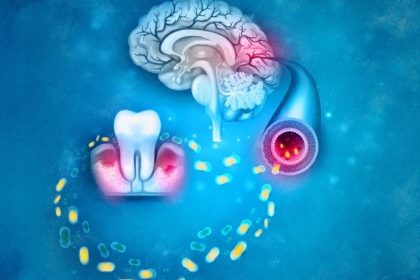 Comment la santé bucco-dentaire pourrait influencer le déclin cognitif