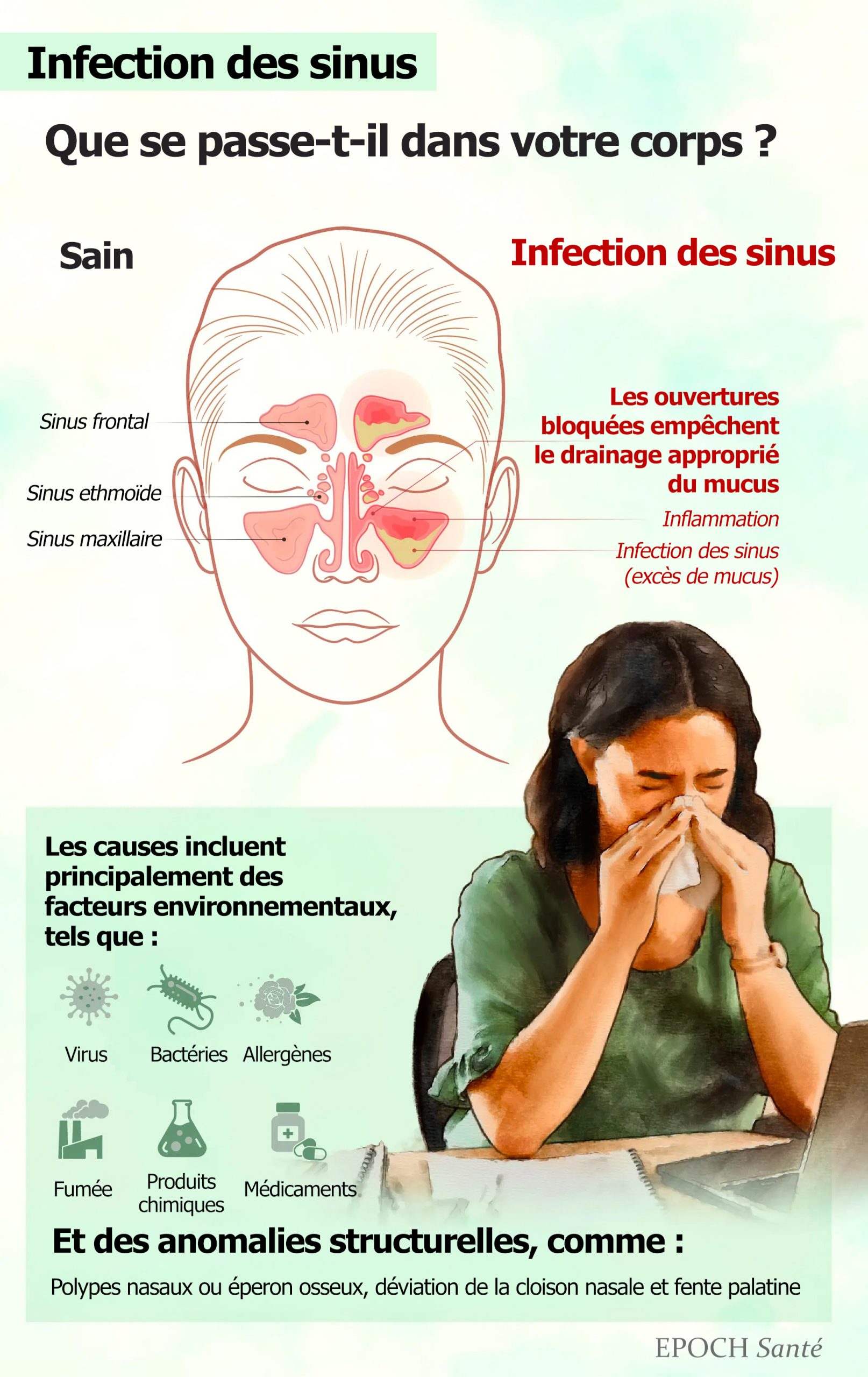 Sinusite : symptmes, causes, traitements et solutions naturelles