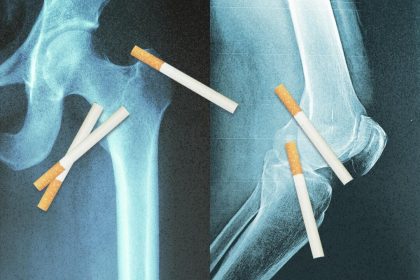 Vos os gardent la mémoire des cigarettes que vous avez fumées