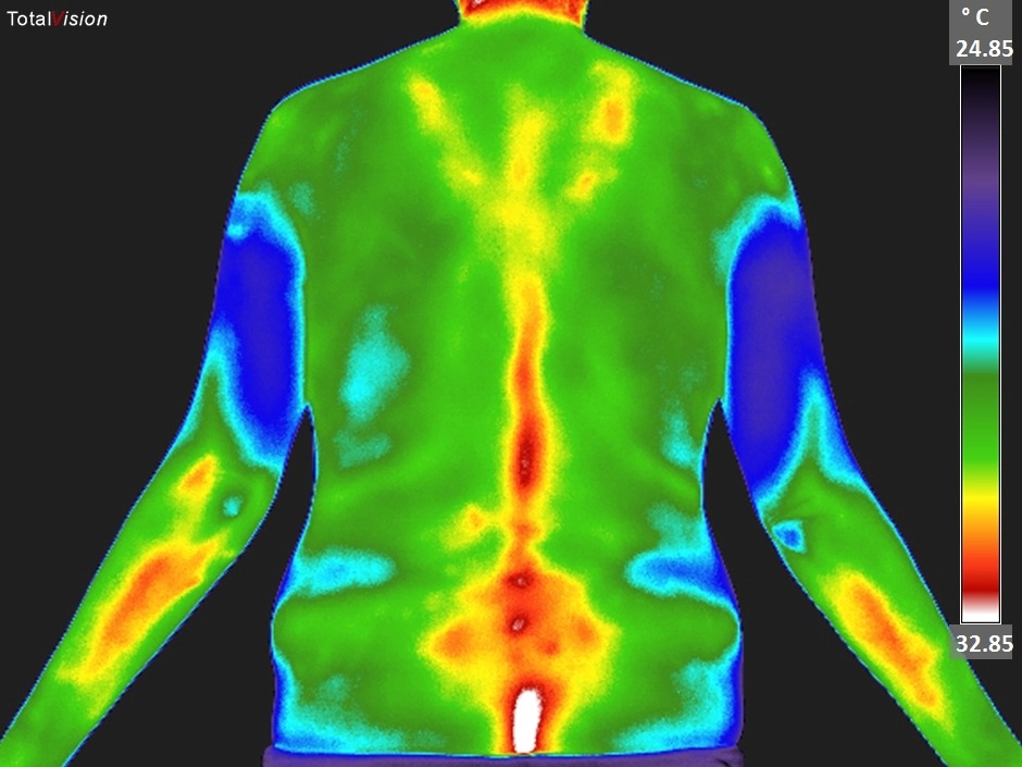 Thermographie ou mammographie : quel examen choisir pour le dépistage du cancer du sein ?