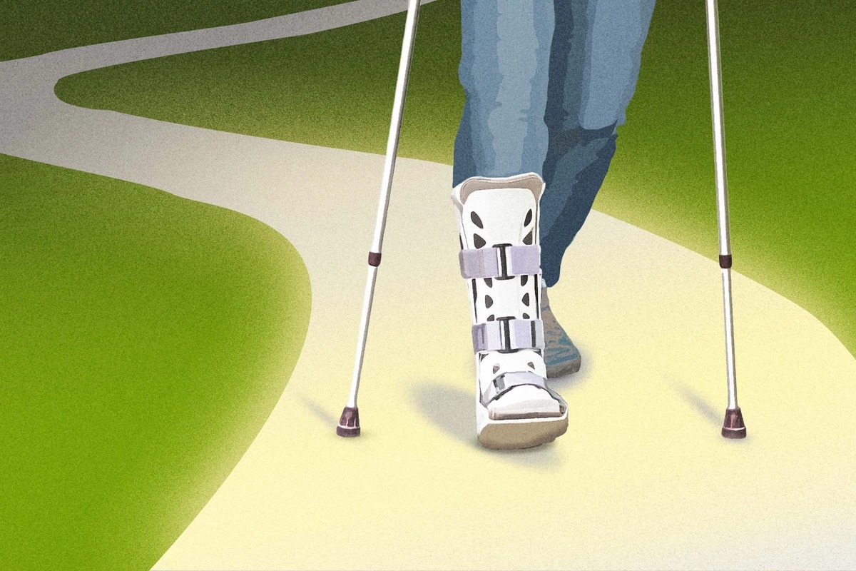 Comment bien récupérer après une fracture osseuse